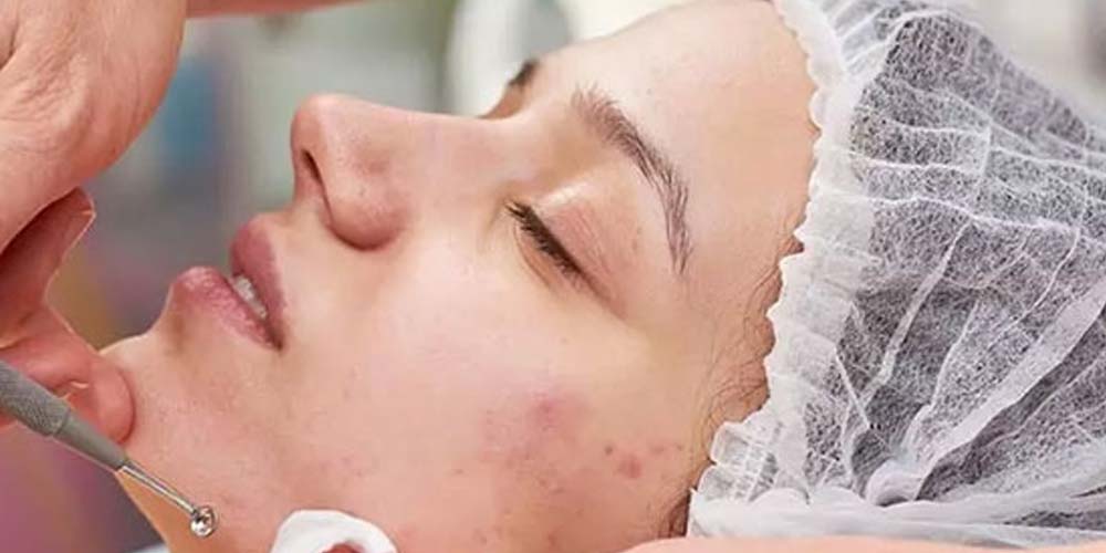 بهترین مرکز فیشیال صورت در شاهین شهر