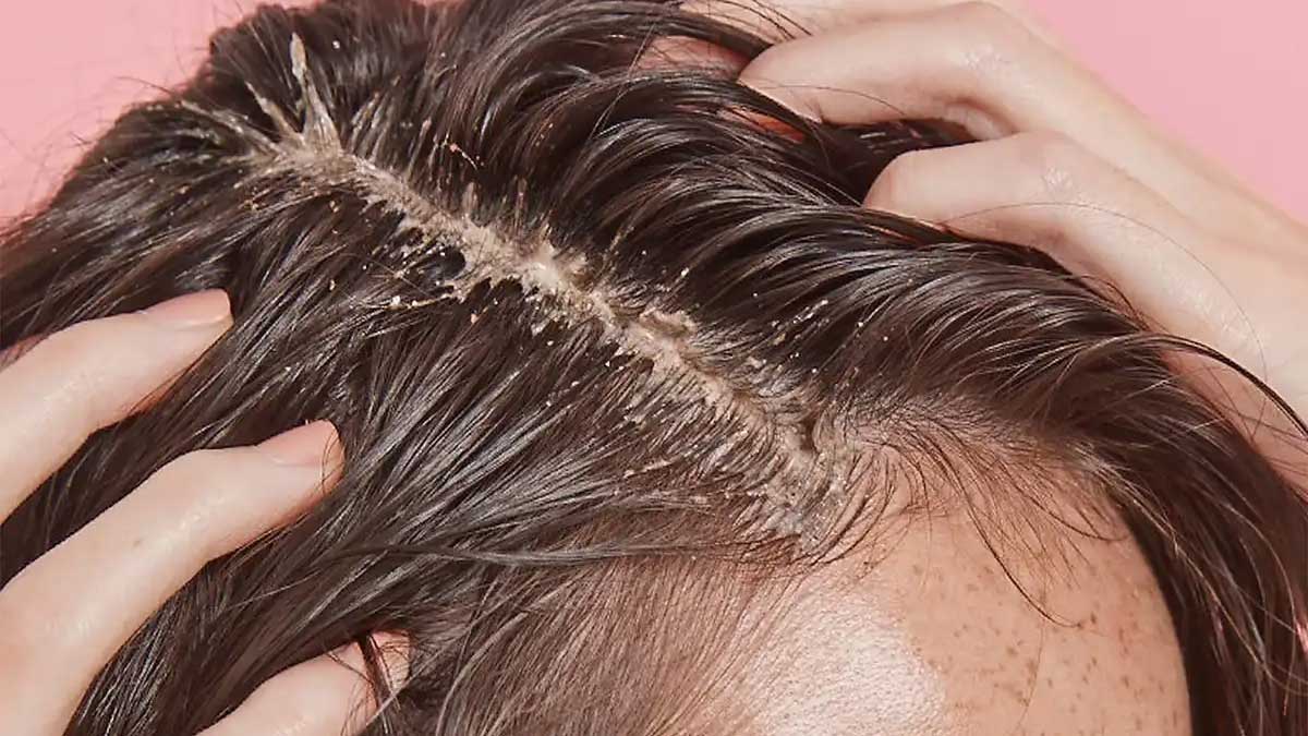 قیمت خدمات میکرواسکالپ در شاهین‌شهر