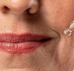 بهترین دکتر تزریق ژل در شاهین‌ شهر